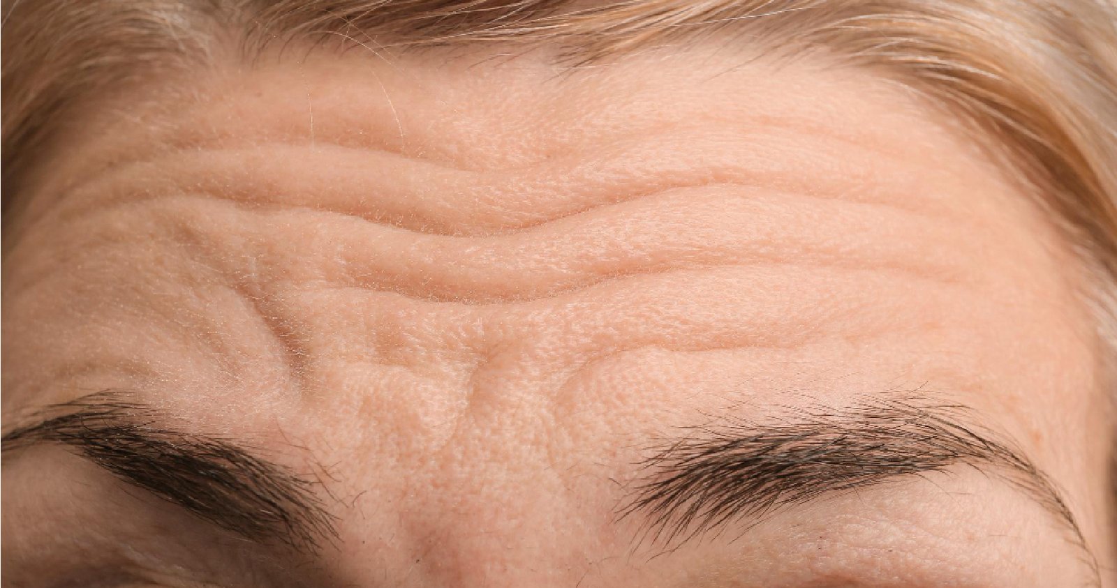 Anti-Aging Treatment In Bangalore